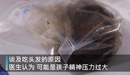 女童吃头发2年塞满胃部是怎么回事?什么情况?终于真相了,原来是这样! 