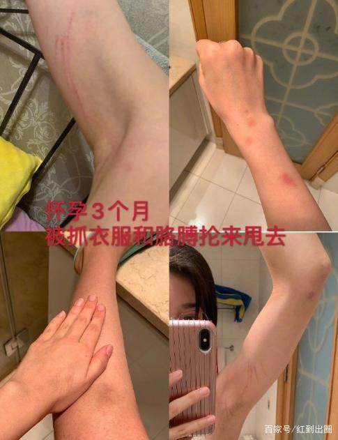 【离婚大战再曝进展】张培萌妻子谈产后第17天被家暴