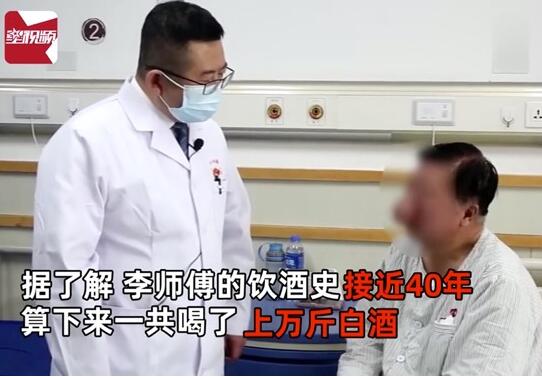太吓人了！40年喝近万斤白酒 56岁大叔喝出大象鼻